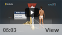 Achilles Tendon Tear Repair