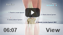 ACL Reconstruction Patellar Tendon