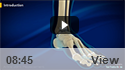 Ankle Joint Replacement