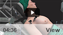 Arthroscopic Bankart Repair