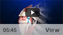 Arthroscopic Rotator Cuff Repair