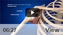 Balloon Implant for Rotator Cuff Tears