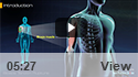 Biceps Tendon Rupture