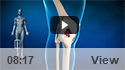 Bridge Enhanced ACL Restoration (BEAR)