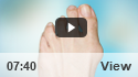 Bunion Surgery