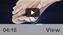 Bunions