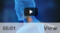Cervical Spine Injections