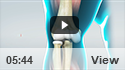 Elbow Sprain