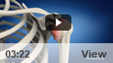 Frozen Shoulder