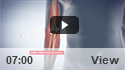 Golfer Elbow