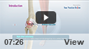 High Tibial Osteotomy
