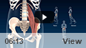 Iliopsoas Tendonitis