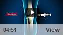 Intra-articular Knee Injections