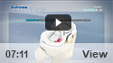 Meniscal Tears
