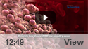 Metastatic Bone Disease