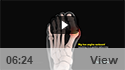 Minimally Invasive Bunion Surgery