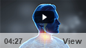 Neck Pain
