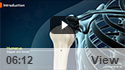 Open Reduction and Internal Fixation of Proximal Humerus Fracture