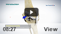 Patellofemoral Instability