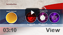 Platelet Rich Plasma Injection (PRP)
