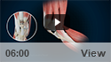 Quadriceps Tendon Rupture and Repair