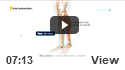 Shin Splints