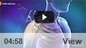 Shoulder Arthroscopy
