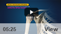 Stemless Total Shoulder Arthroplasty