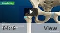 Subtrochanteric Hip Fracture