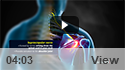 Suprascapular Nerve Block